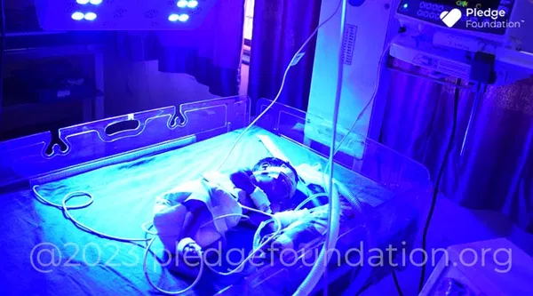 Urgent Ventilator Support Needed for Baby of Manjula who is Born Premature