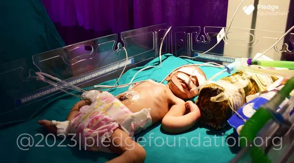 Born Prematurely with Fatal Clinical Sepsis, Thrombocytopenia & Pulmonary Hypertension | Save life of Jyoti’s Newborn