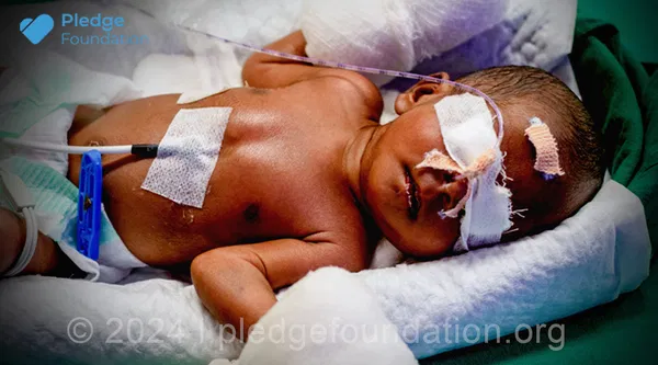 Already Went through Knife Once | Save life of 10 days old Baby still in NICU
