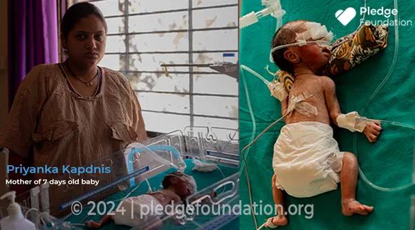 6.5 month old premature baby needs NICU Stay to Survive | Help Priyanka Save her Baby