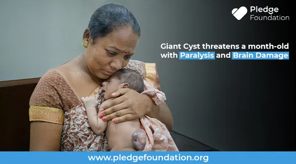 Giant Cyst threatens newborn with Paralysis and Brain Damage!