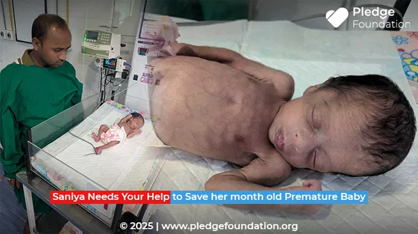 Help Saniya Save her only Month-Old Premature Baby | Donate Now