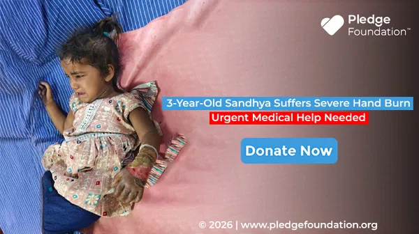3-Year-Old Sandhya Suffers Severe Hand Burn | Urgent Medical Help Needed