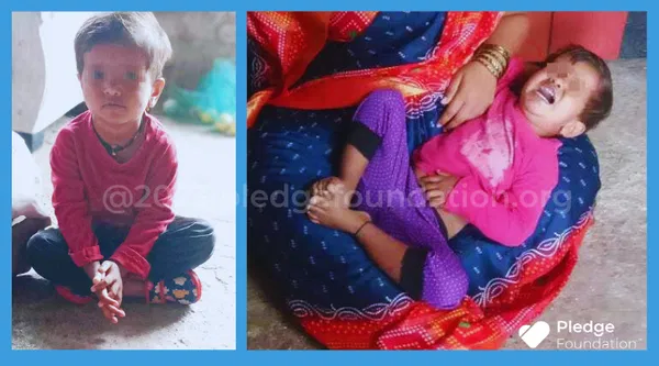 With a Hole in Her Heart; 2 year old Pallavi is Fighting for Life