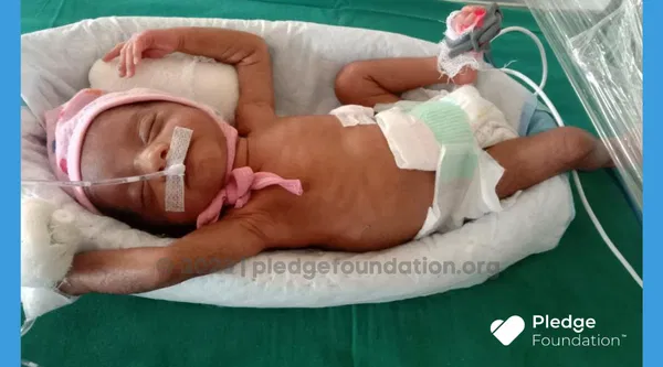 Merely 800 gms; this 7-month-old needs Baby Girl Needs NICU Stay