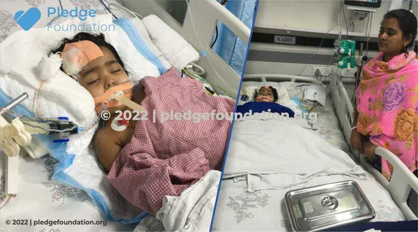 A 4-year-old girl is battling between life and death. Help her now