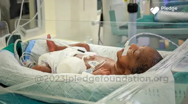 Baby Born Prematurely in 6th month due to Mother’s Heavy Bleeding during Pregnancy