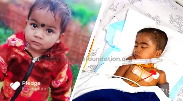 Help 4 year old Rohit Recover from Deadly Brain Tumor Urgently!