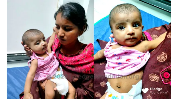 4-Month-Old’s Only Chance Of Survival Is An Urgent Life Saving, Total Correction Heart Surgery!
